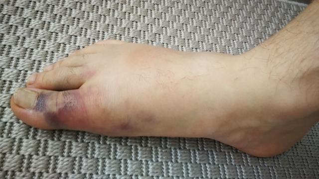 Picture for question