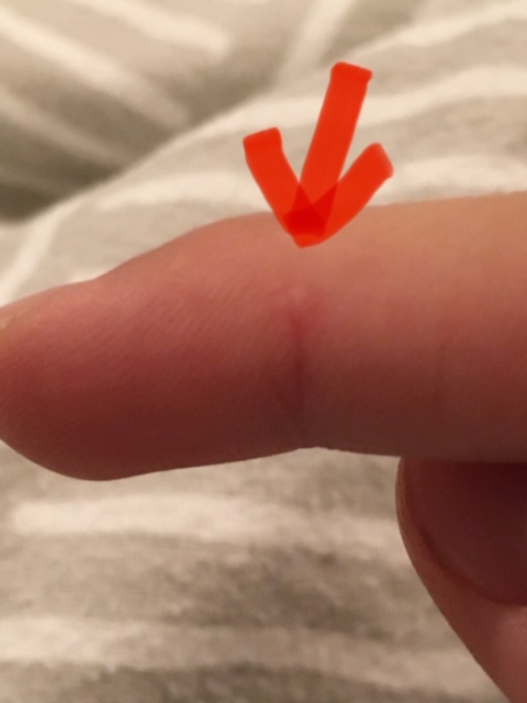 Picture for question