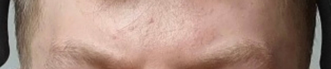 Picture for question