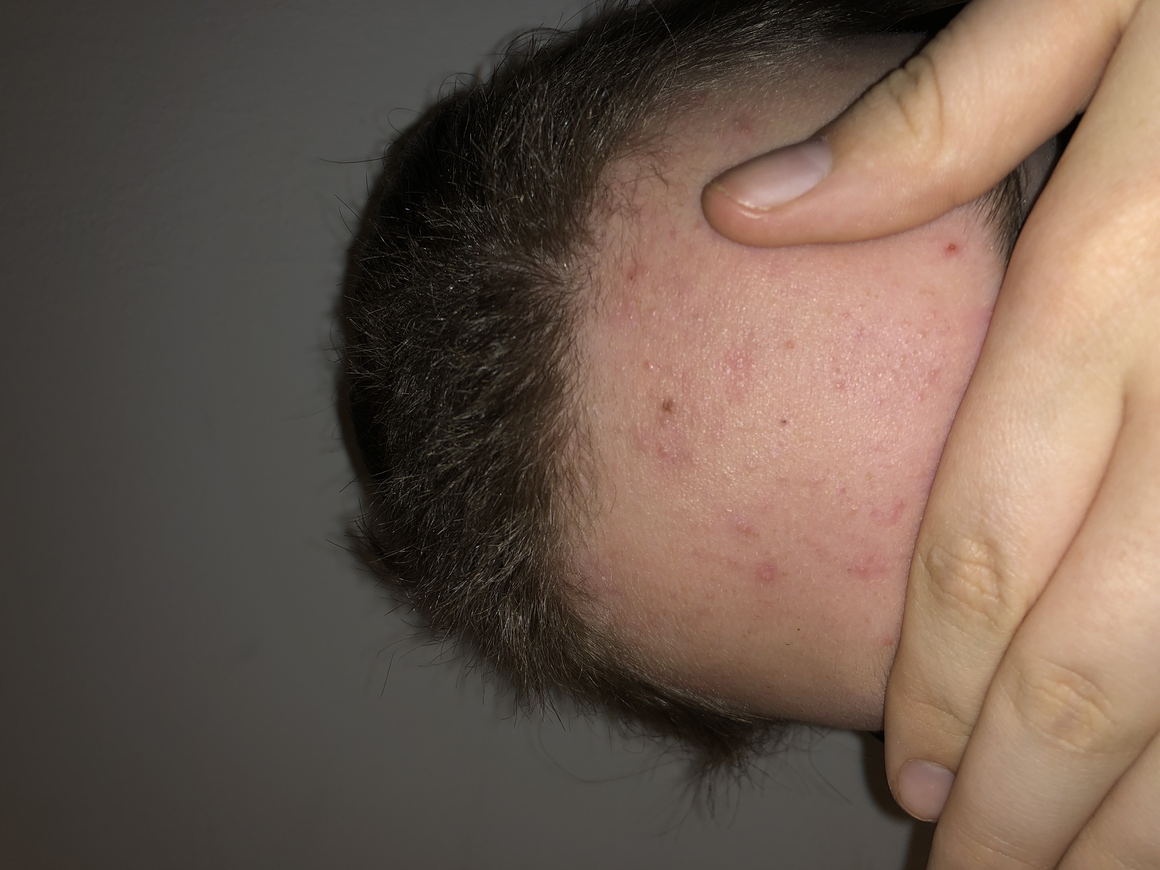 Picture for question