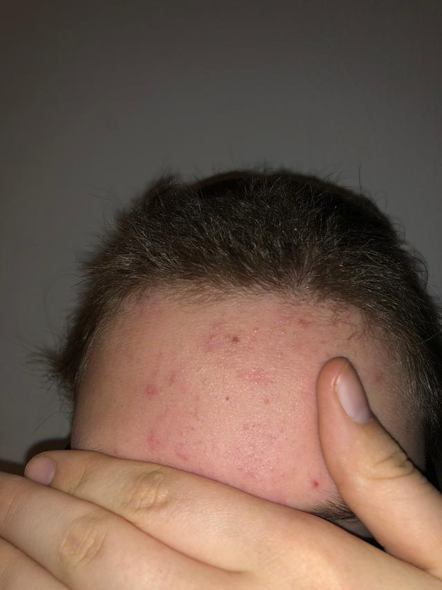 Picture for question