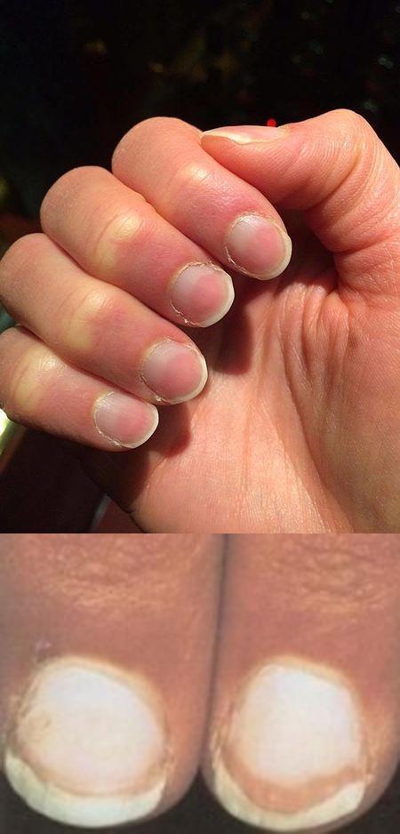 Plaatje bij antwoord