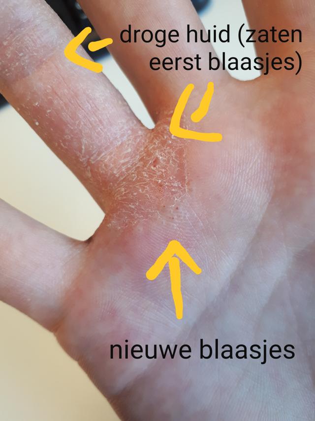 Picture for question