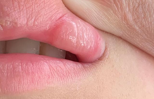 Picture for question