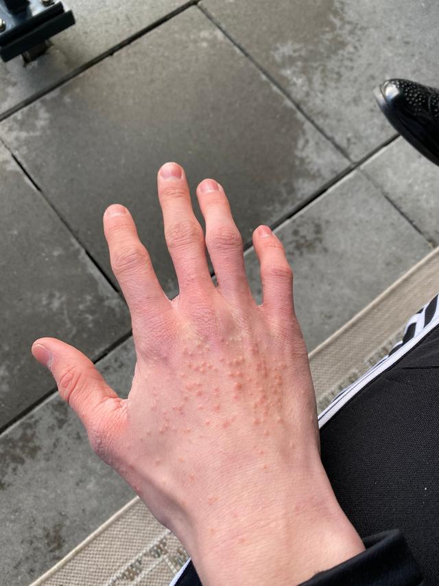 Picture for question