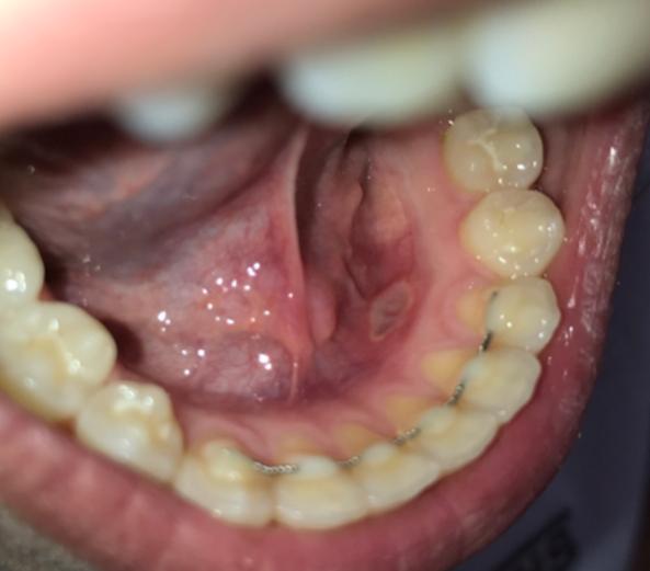 Picture for question