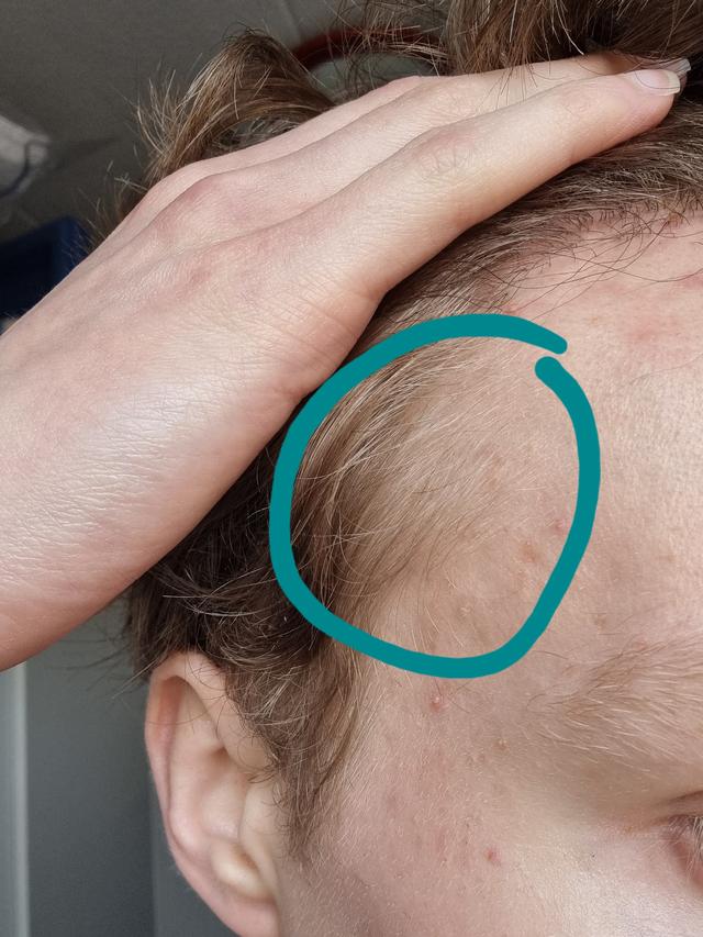 Picture for question