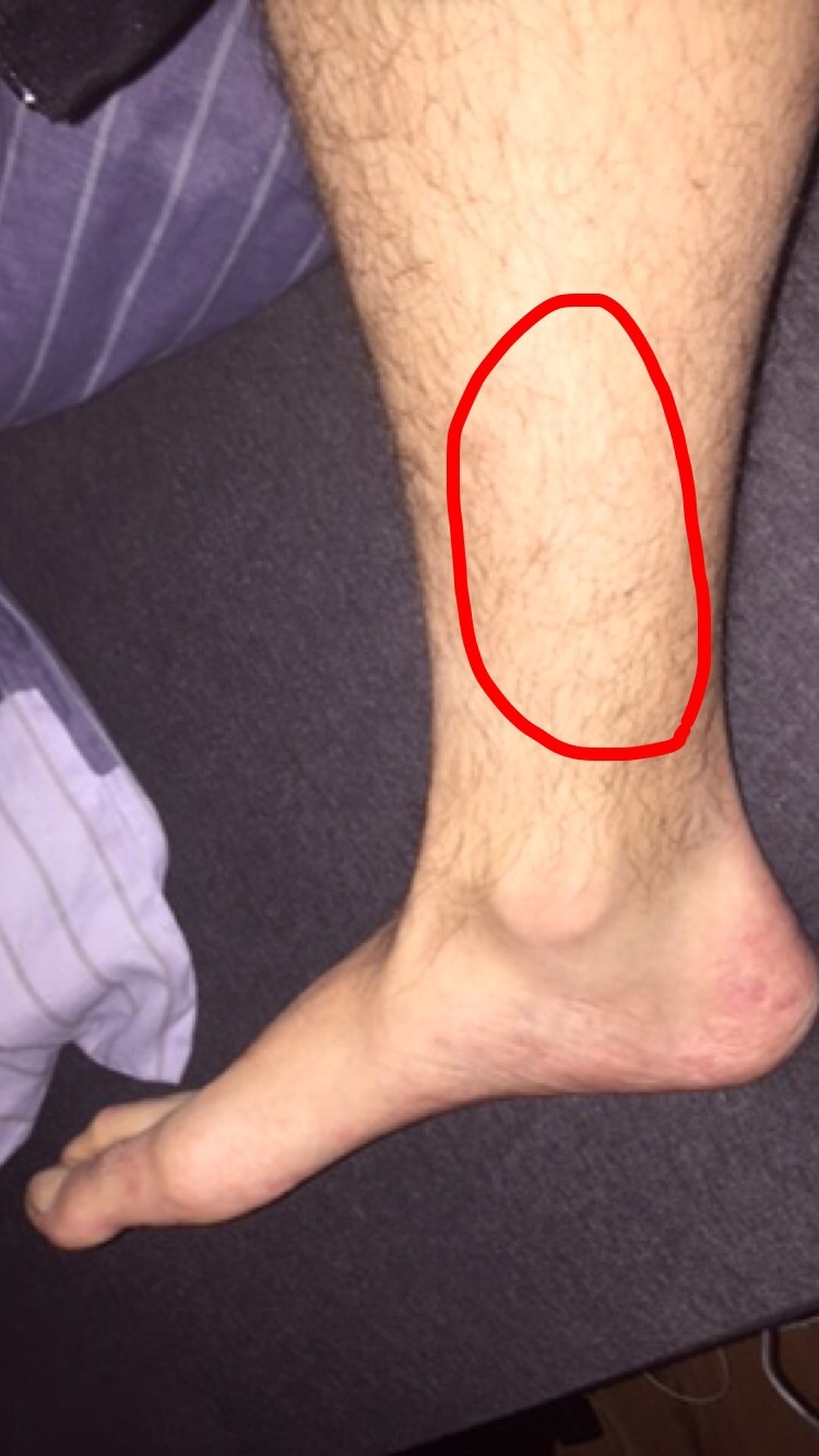 Picture for question