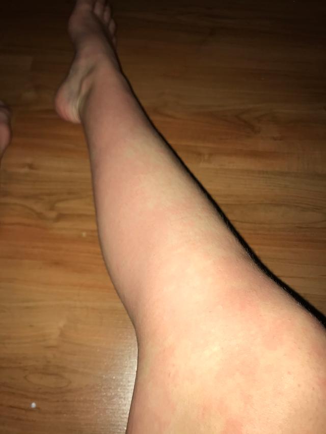 Picture for question