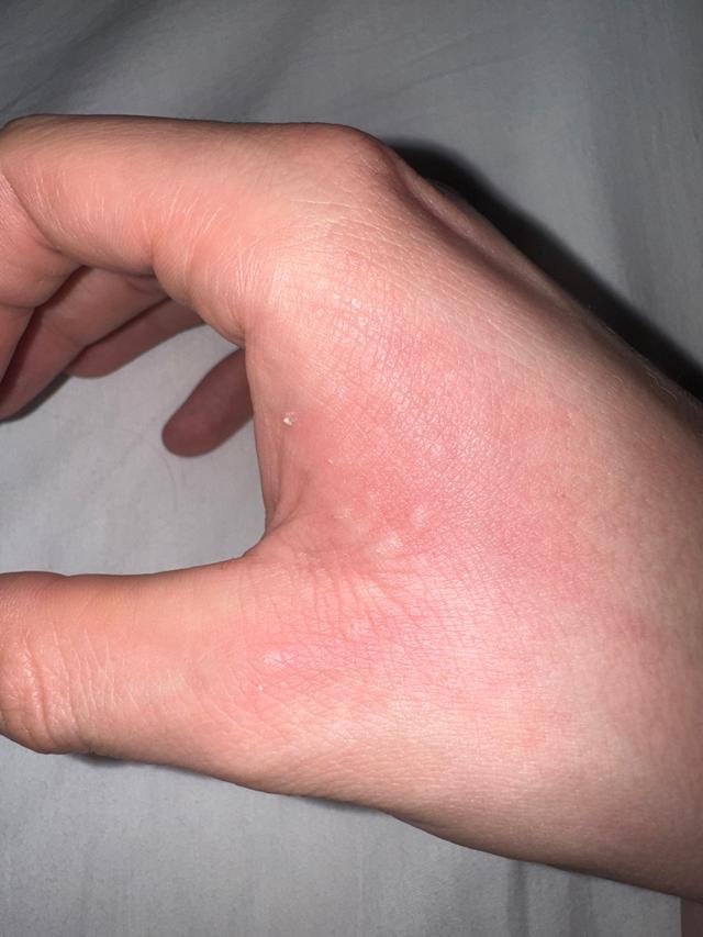 Picture for question