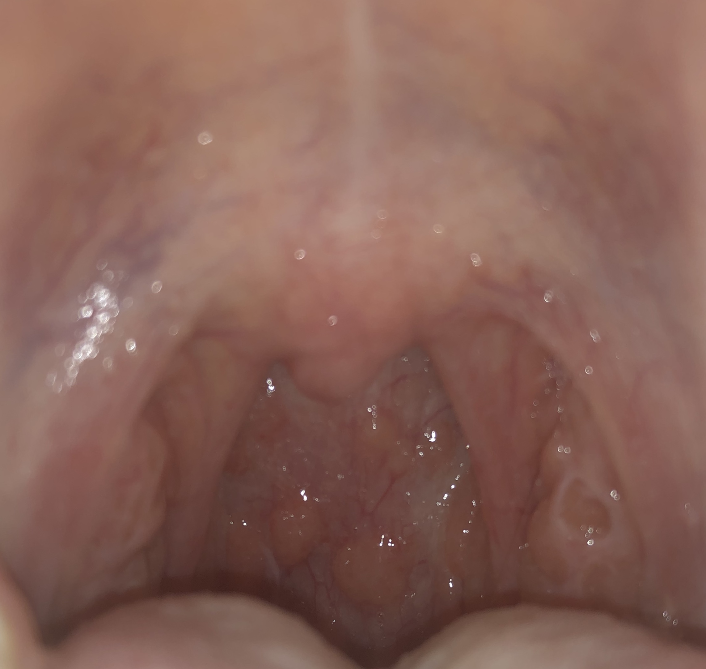 Picture for question