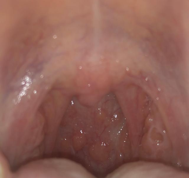 Picture for question