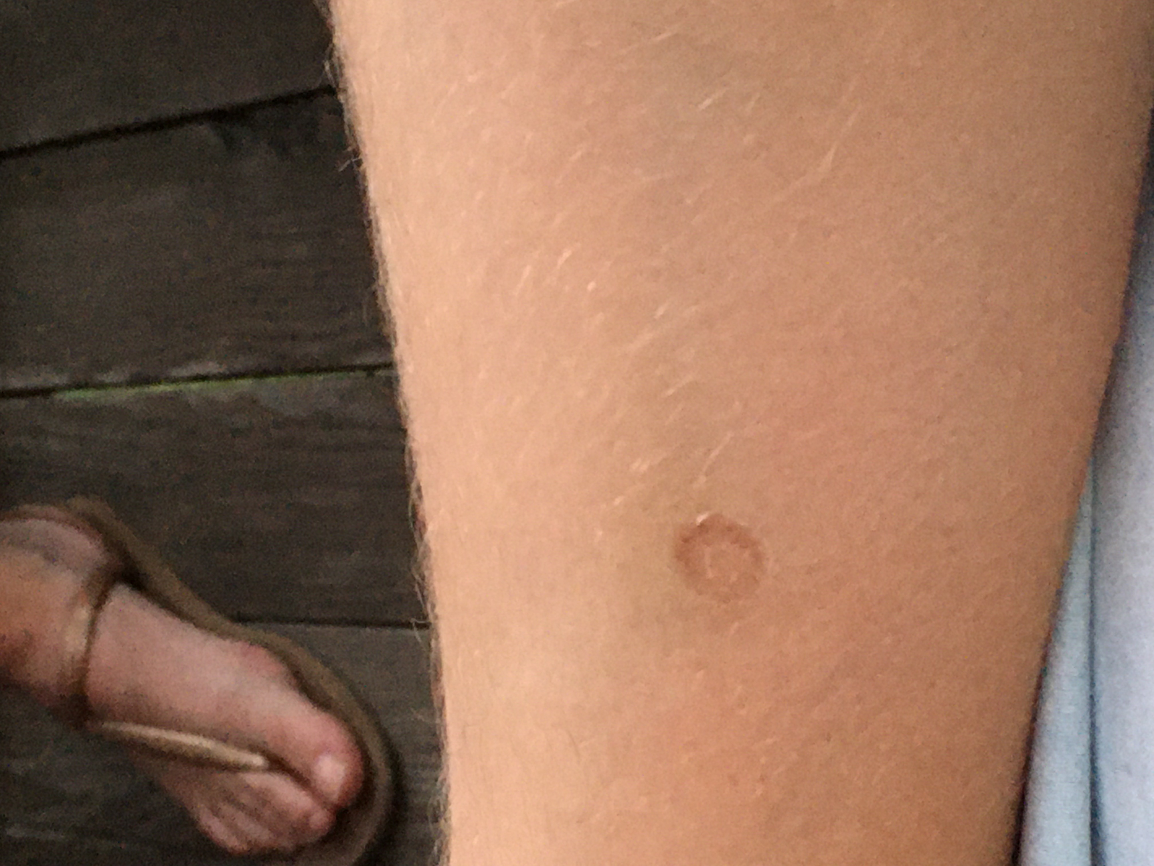 Picture for question