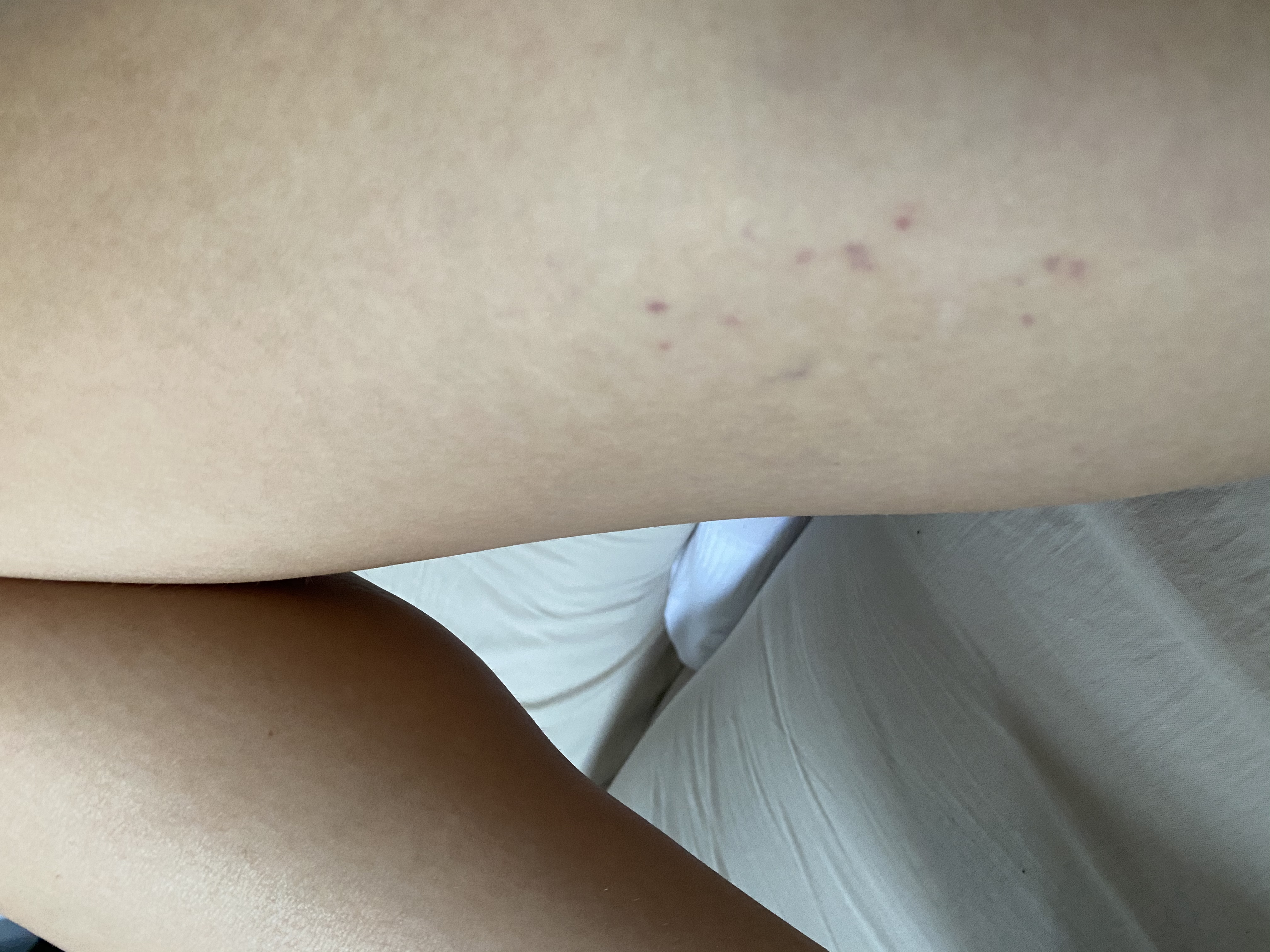 Picture for question