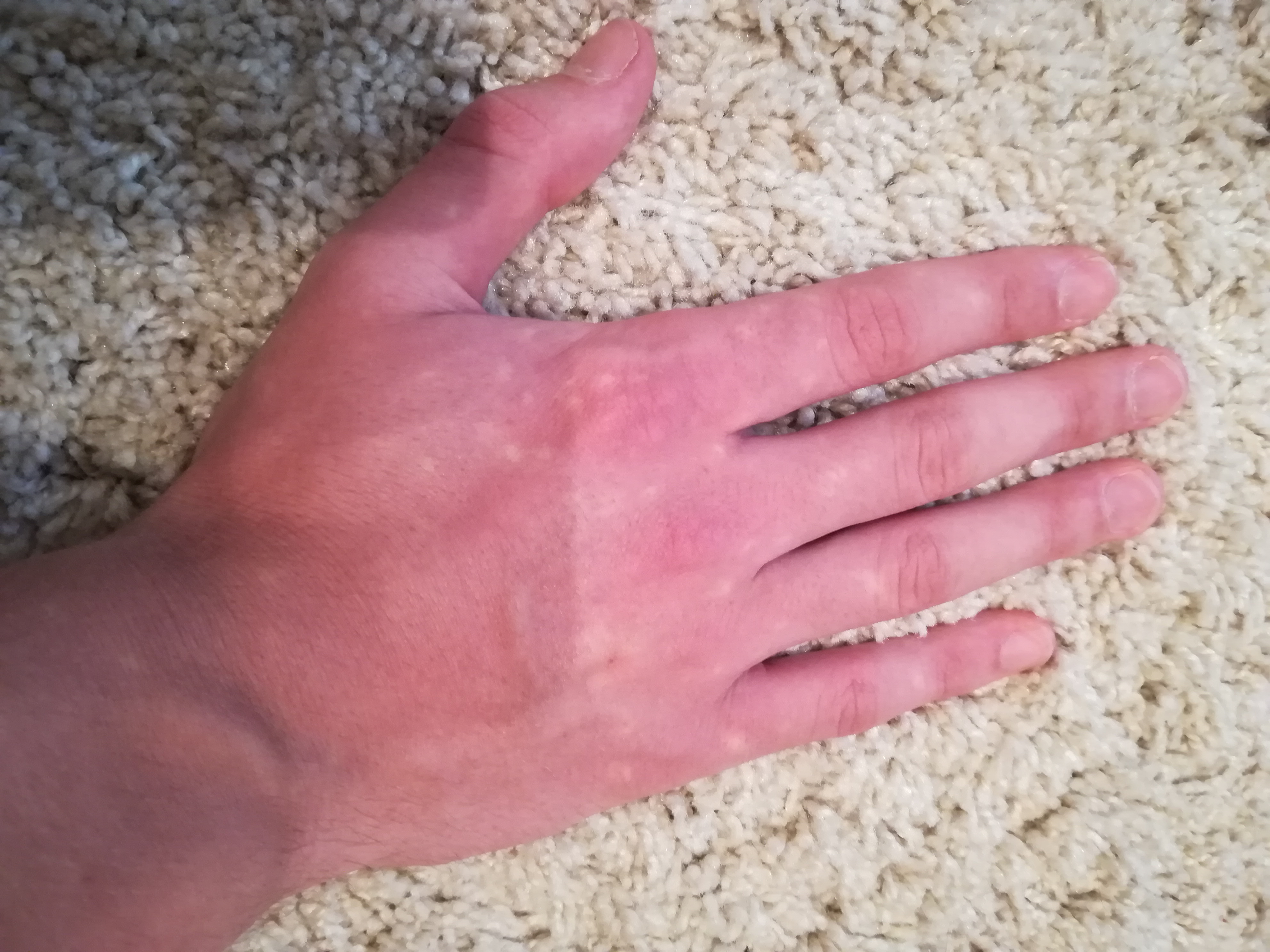 Picture for question