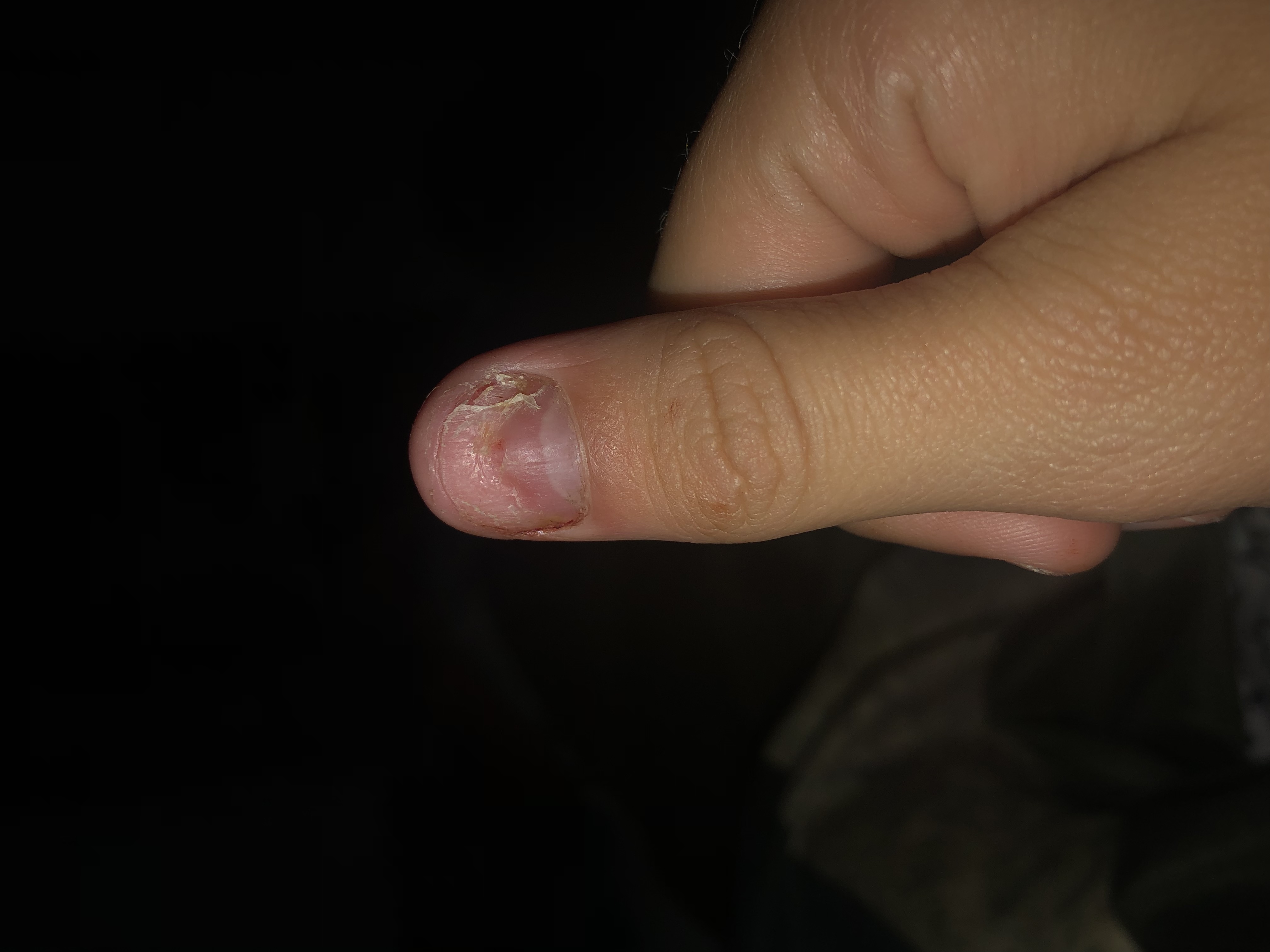 Picture for question