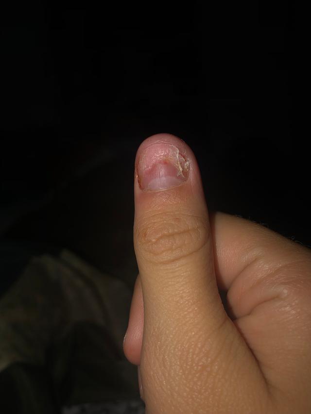 Picture for question