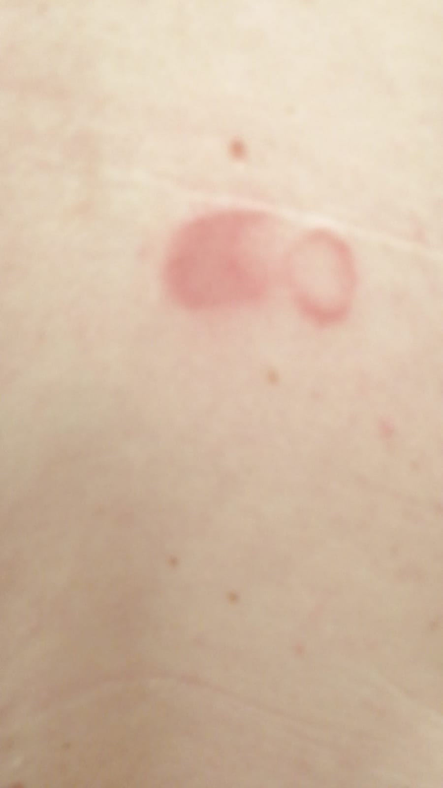 Picture for question