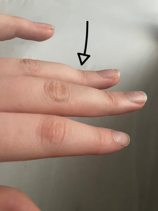 Picture for question