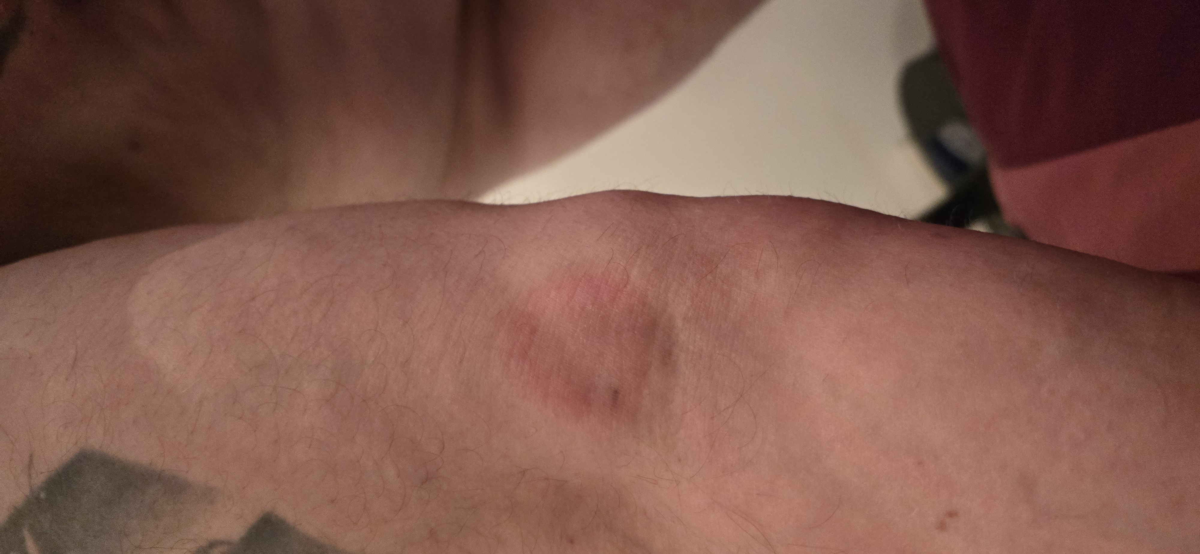 Picture for question