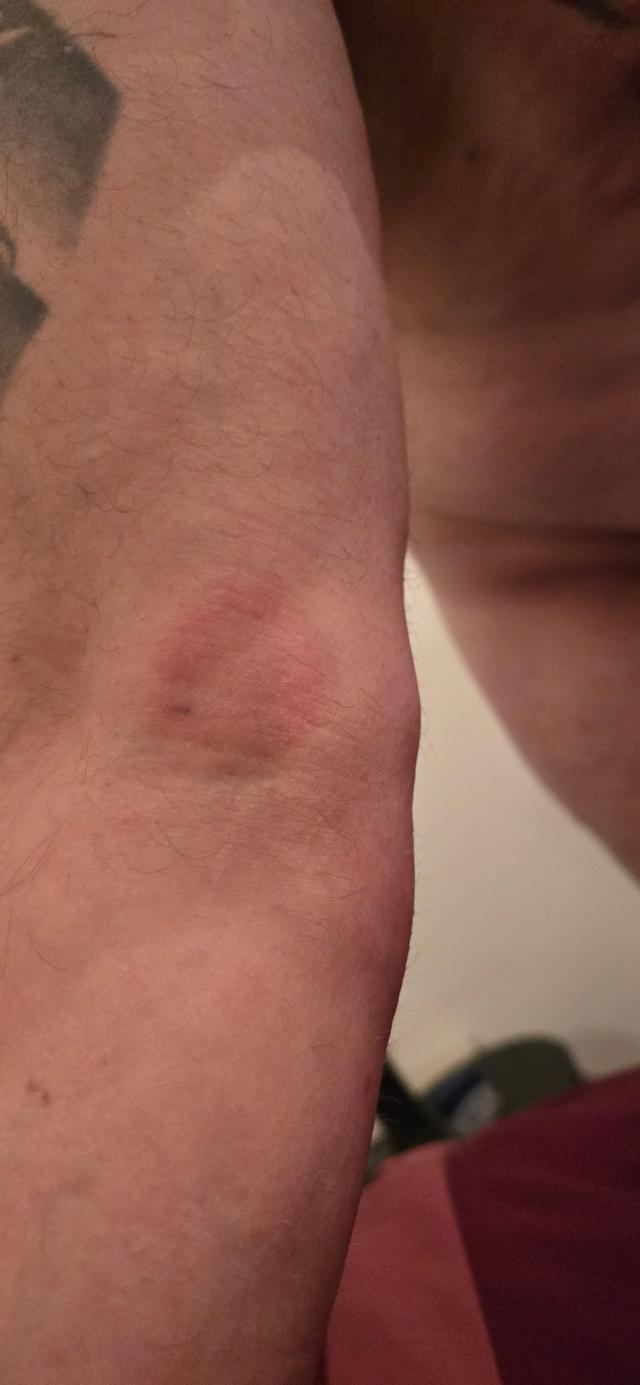 Picture for question