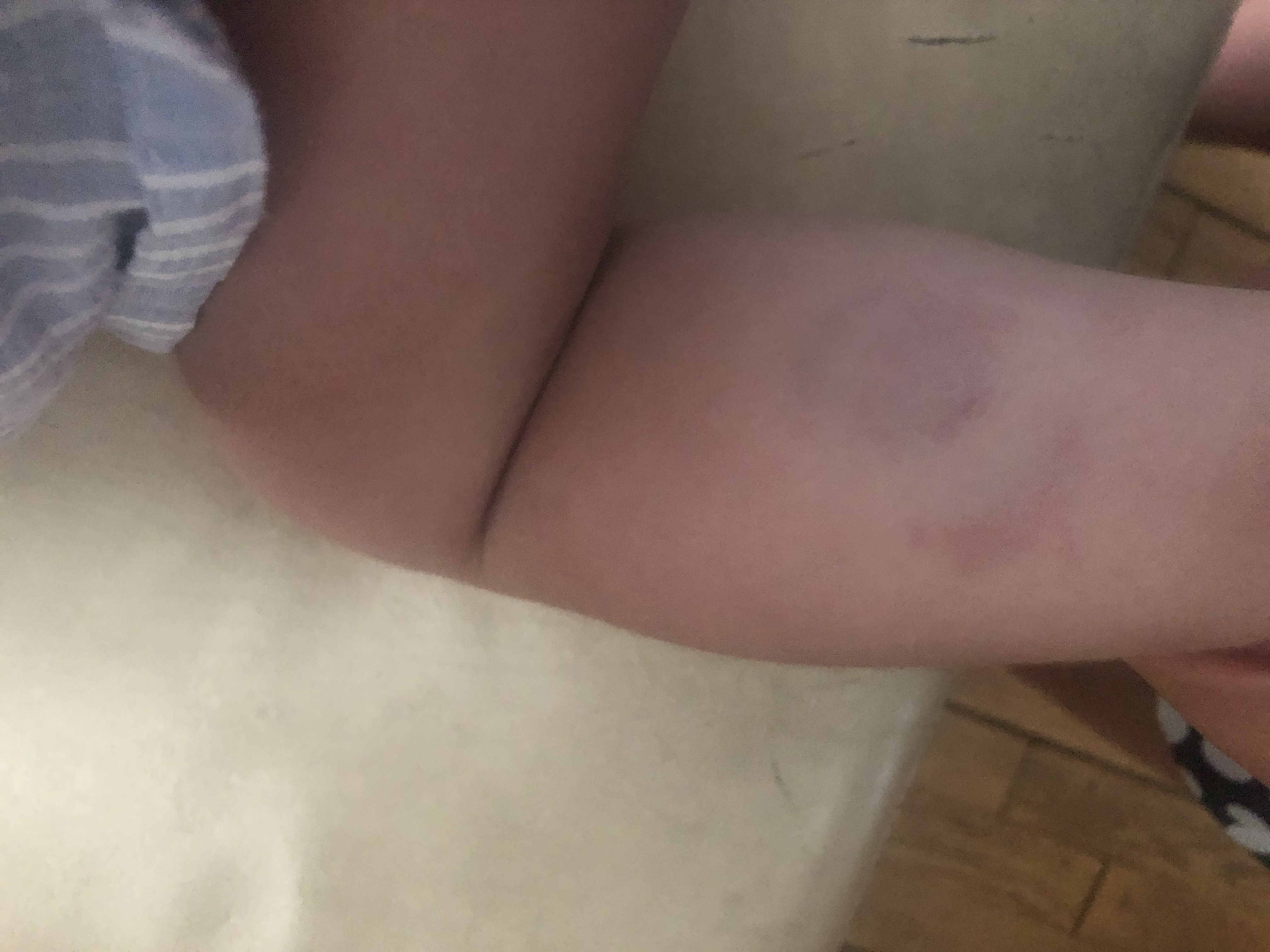 Picture for question