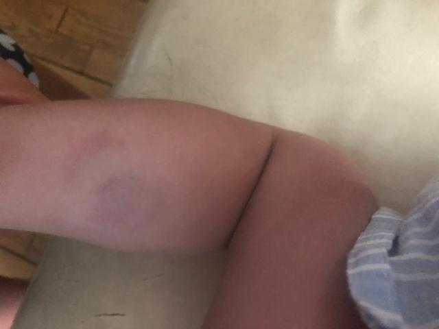 Picture for question