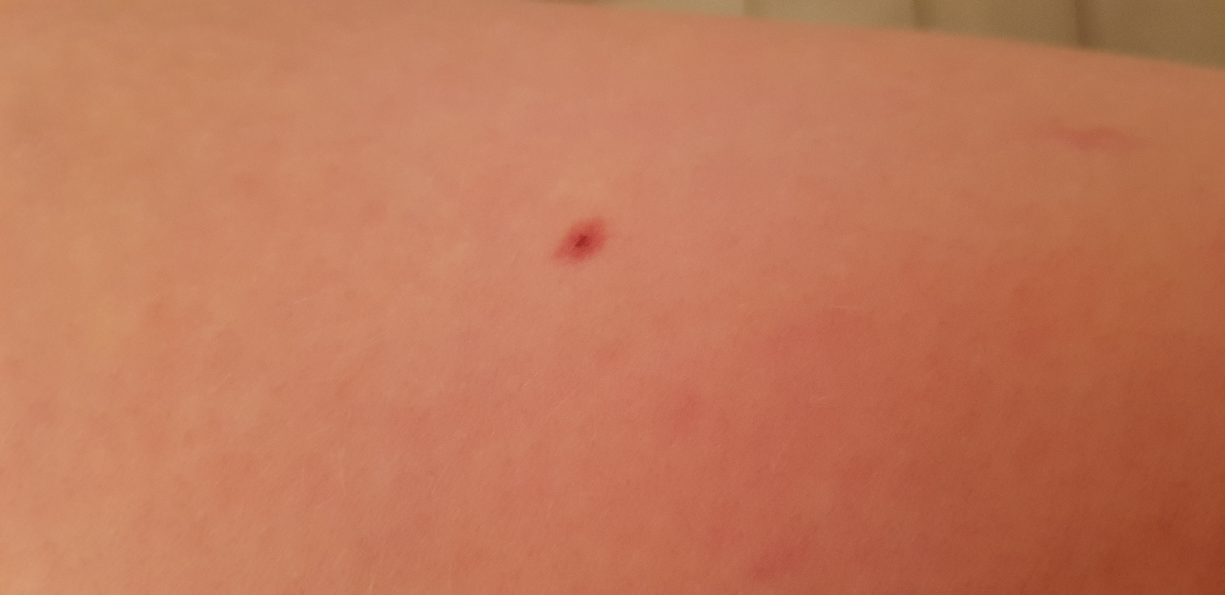 Picture for question