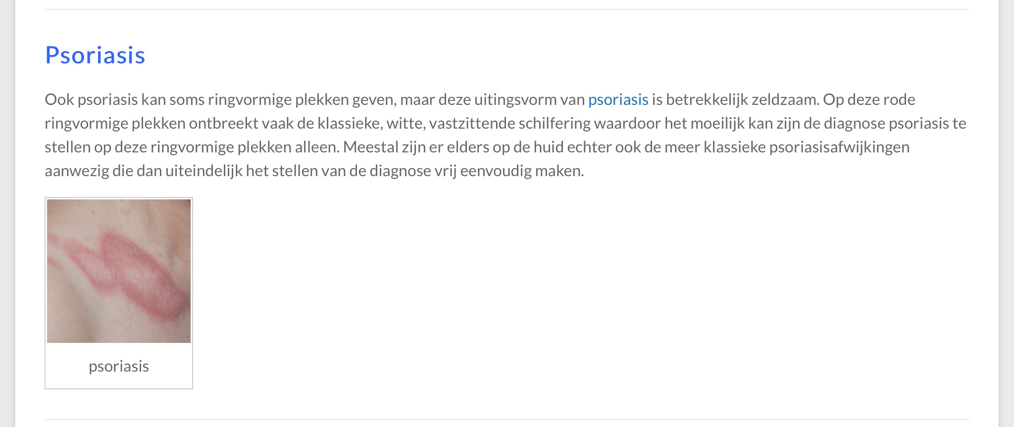 Plaatje bij antwoord