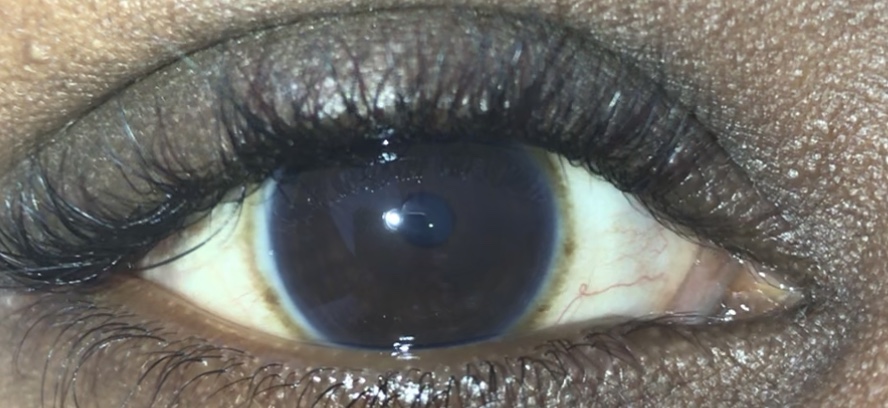 Picture for question