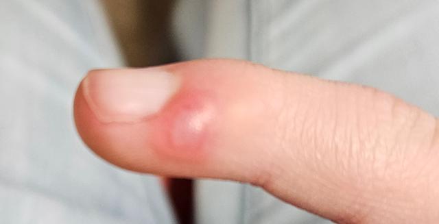 Picture for question