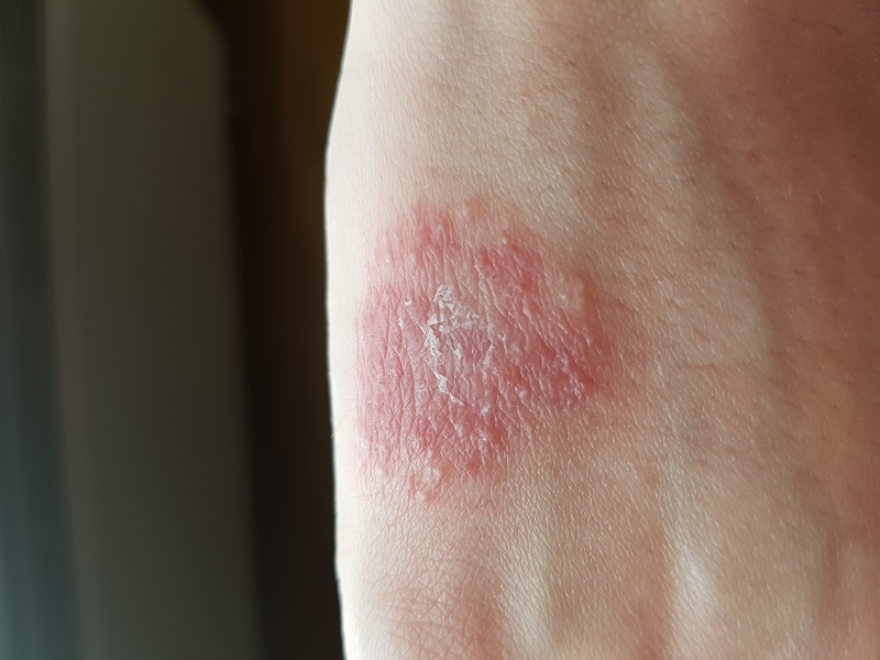 Picture for question