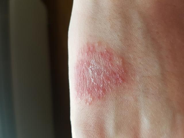 Picture for question