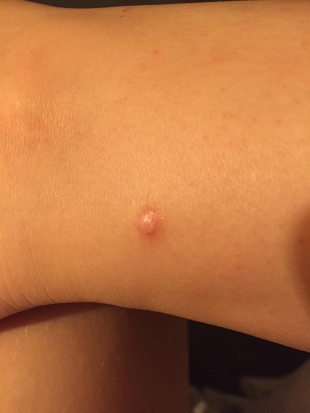 Picture for question