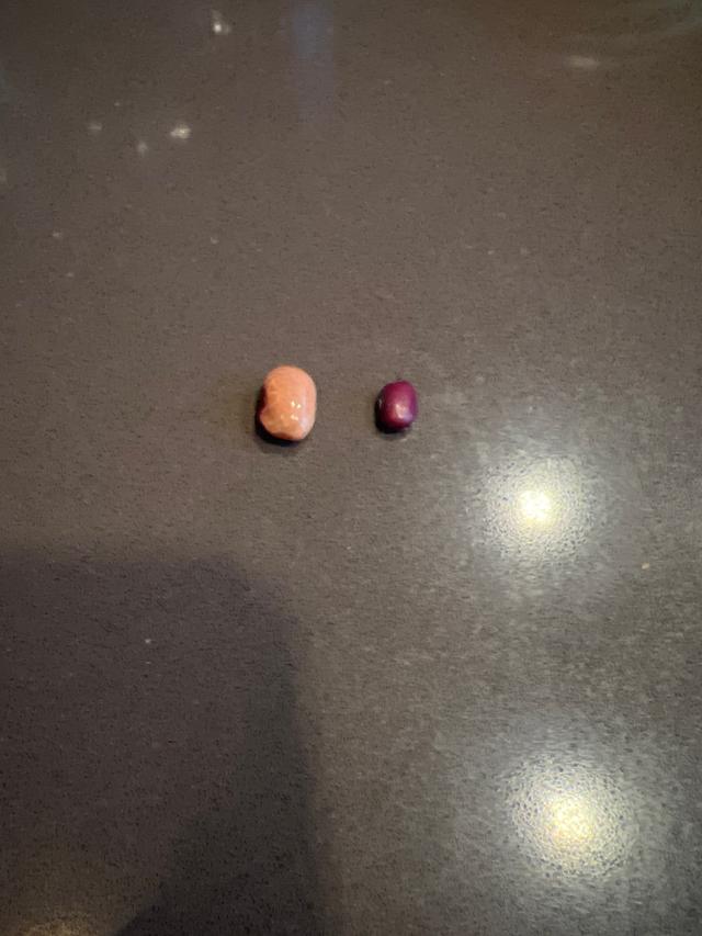 Picture for question