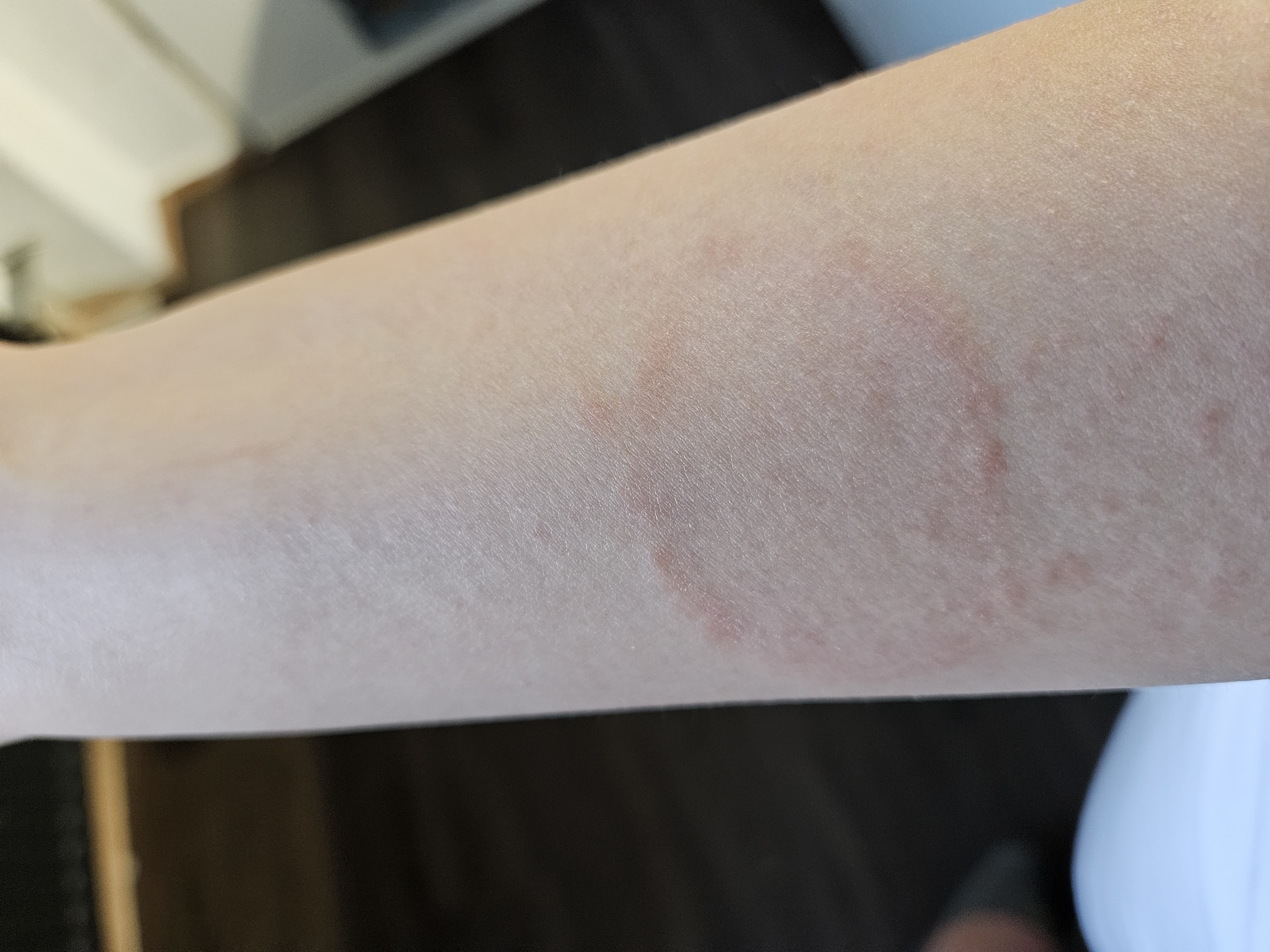 Picture for question