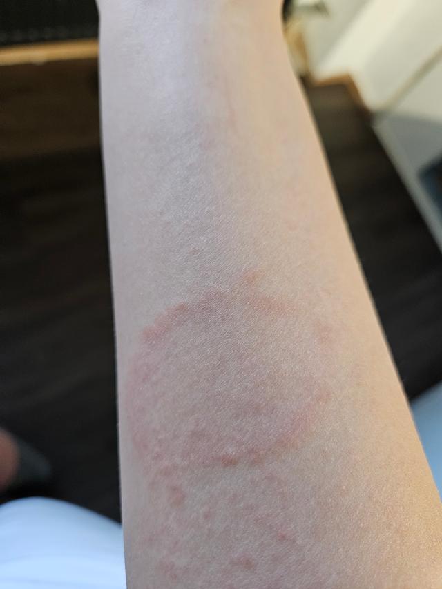 Picture for question