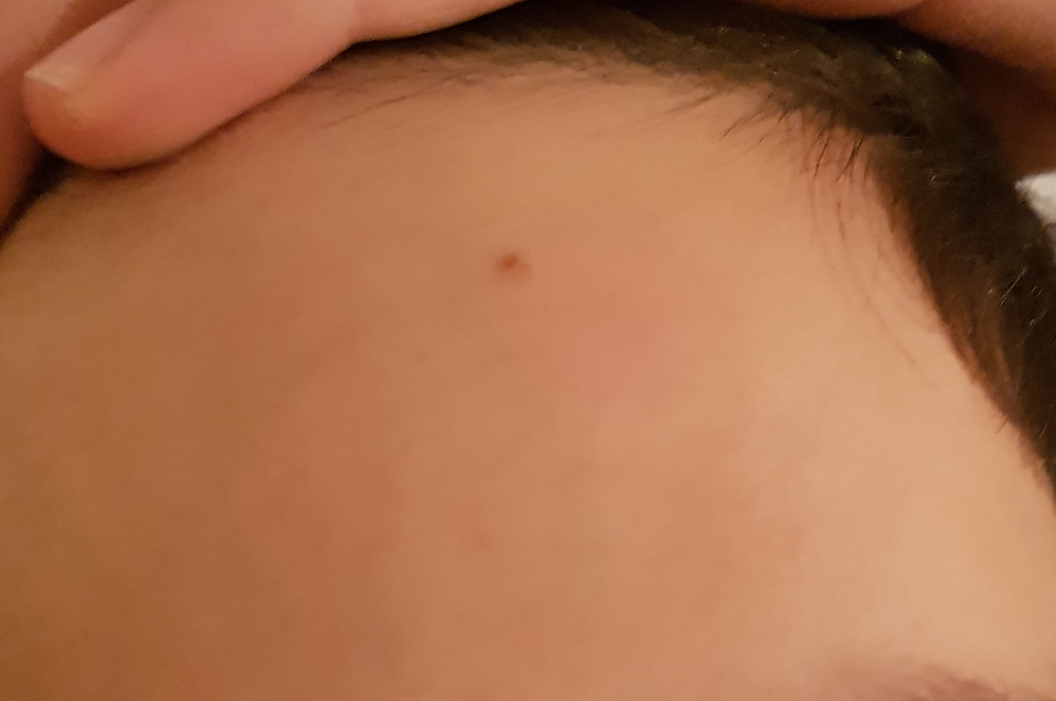 Picture for question