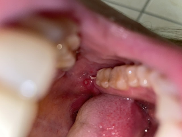 Picture for question