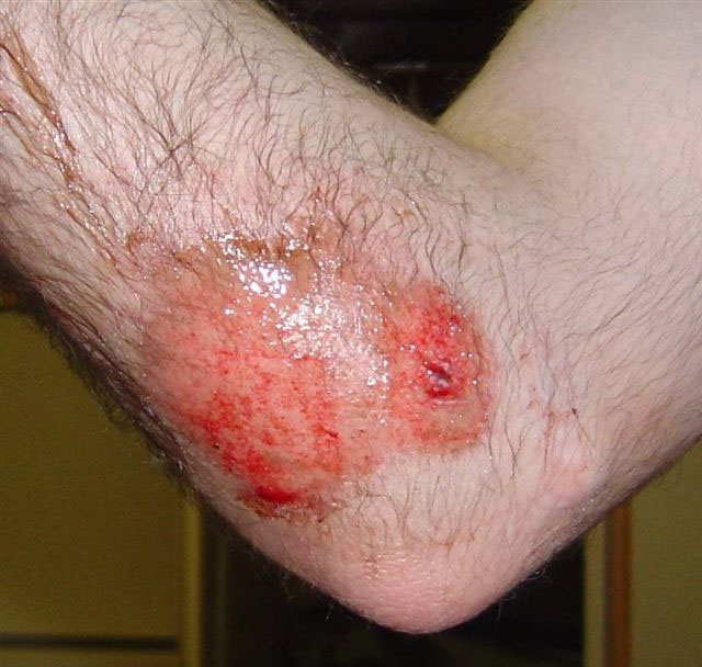 Picture for question