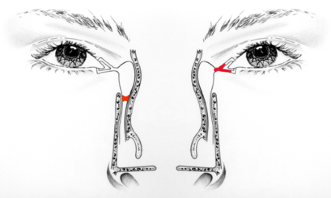 Plaatje bij antwoord