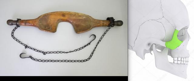 Plaatje bij antwoord