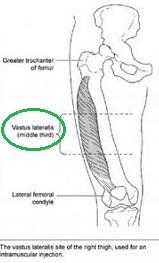 Plaatje bij antwoord