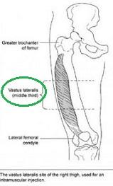 Plaatje bij antwoord