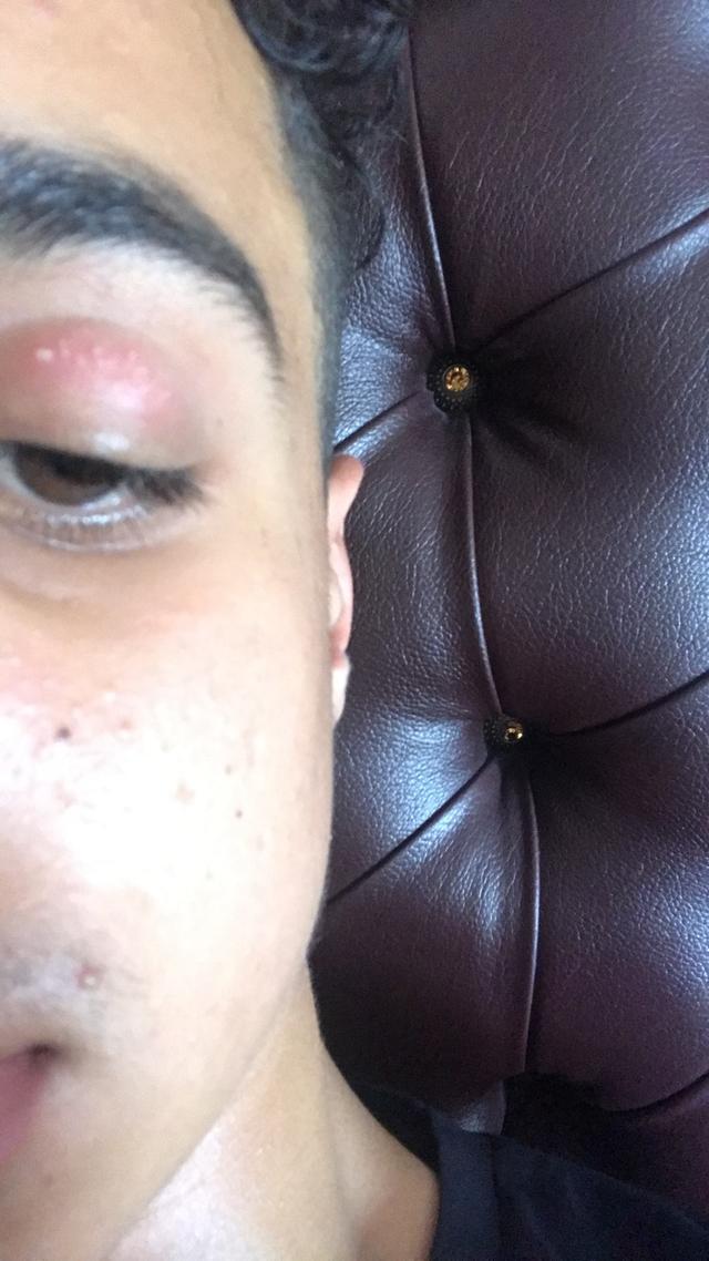 Picture for question