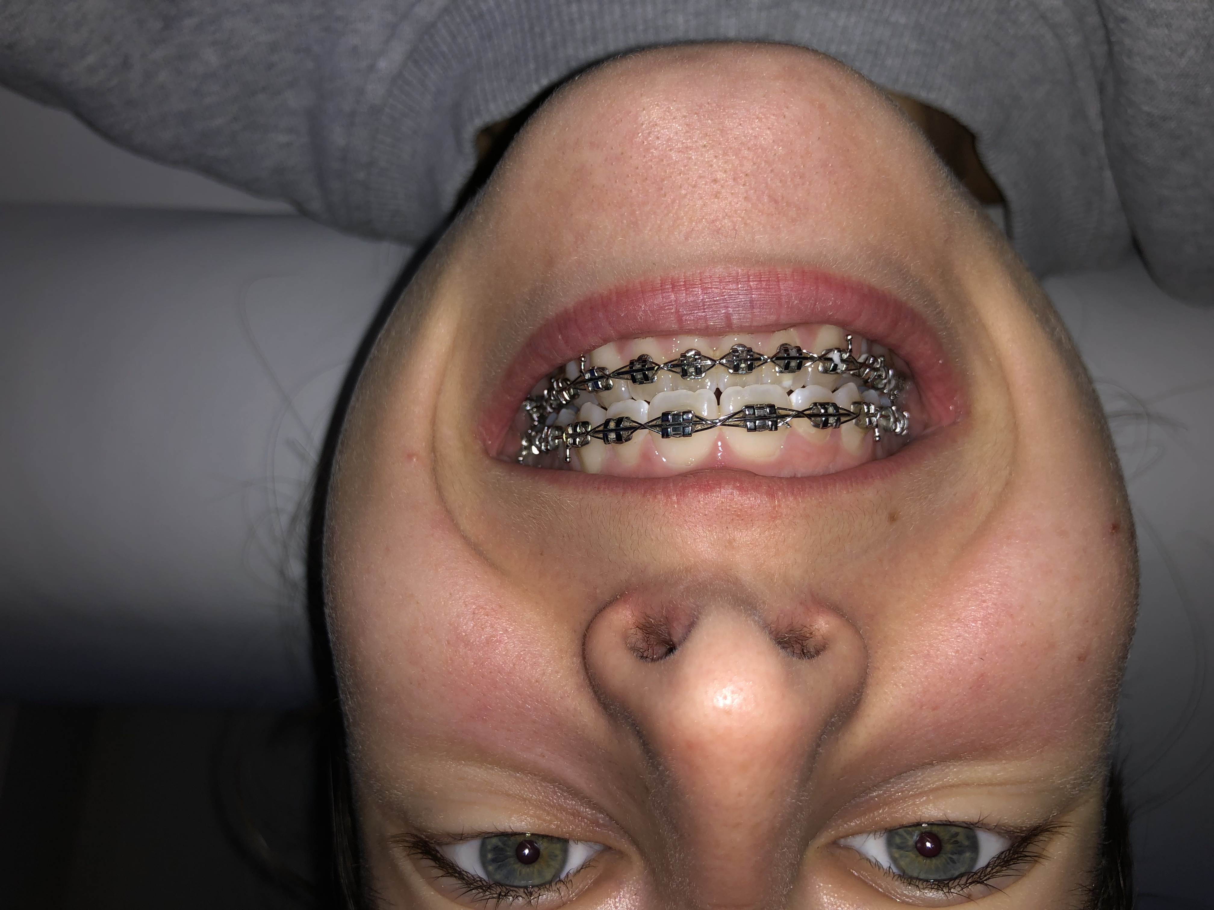 Picture for question