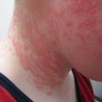 Plaatje bij antwoord