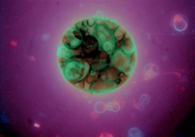 Plaatje bij antwoord