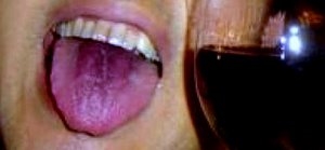 Plaatje bij antwoord