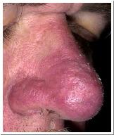 Plaatje bij antwoord